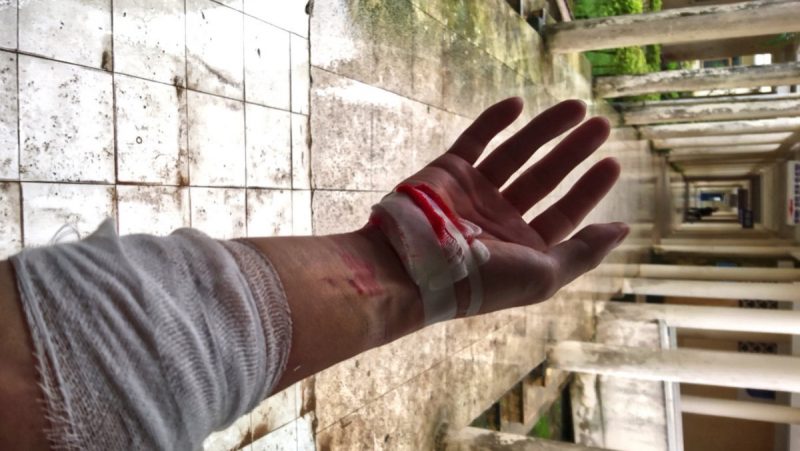 Motorcycle Accident Injuries in Vietnam /// Vinjatek